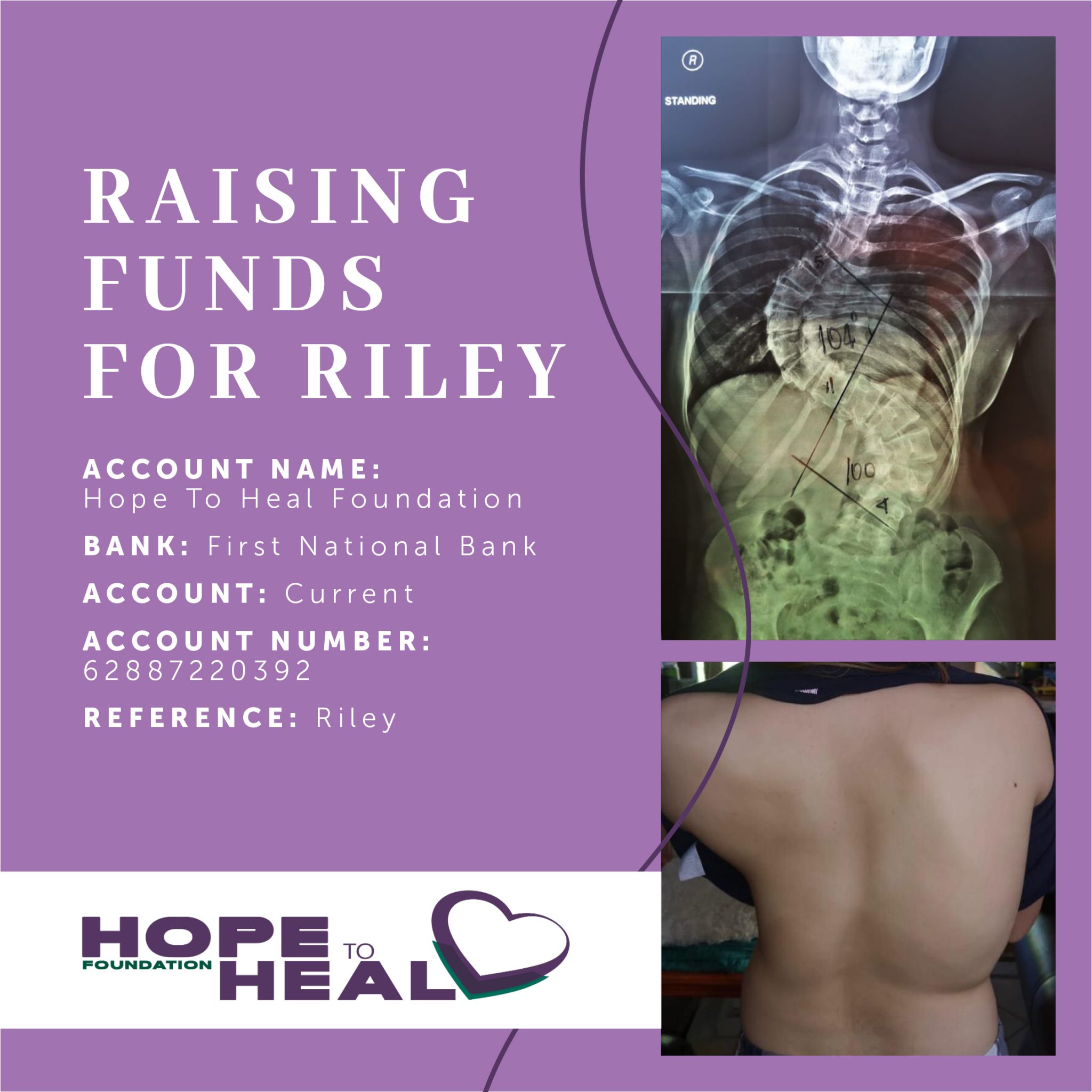 Fund Raising for Riley Hope To Heal Foundation